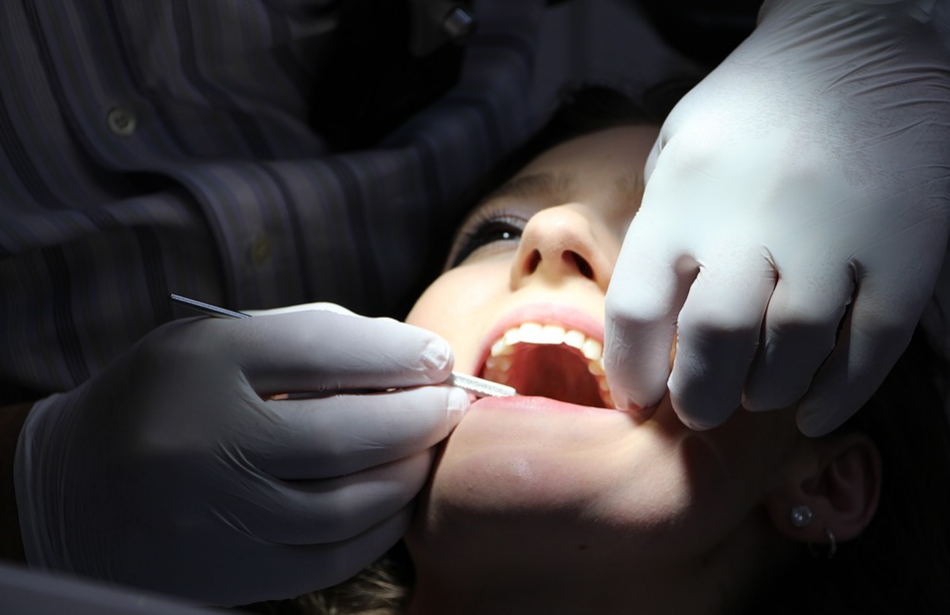 teeth whitening